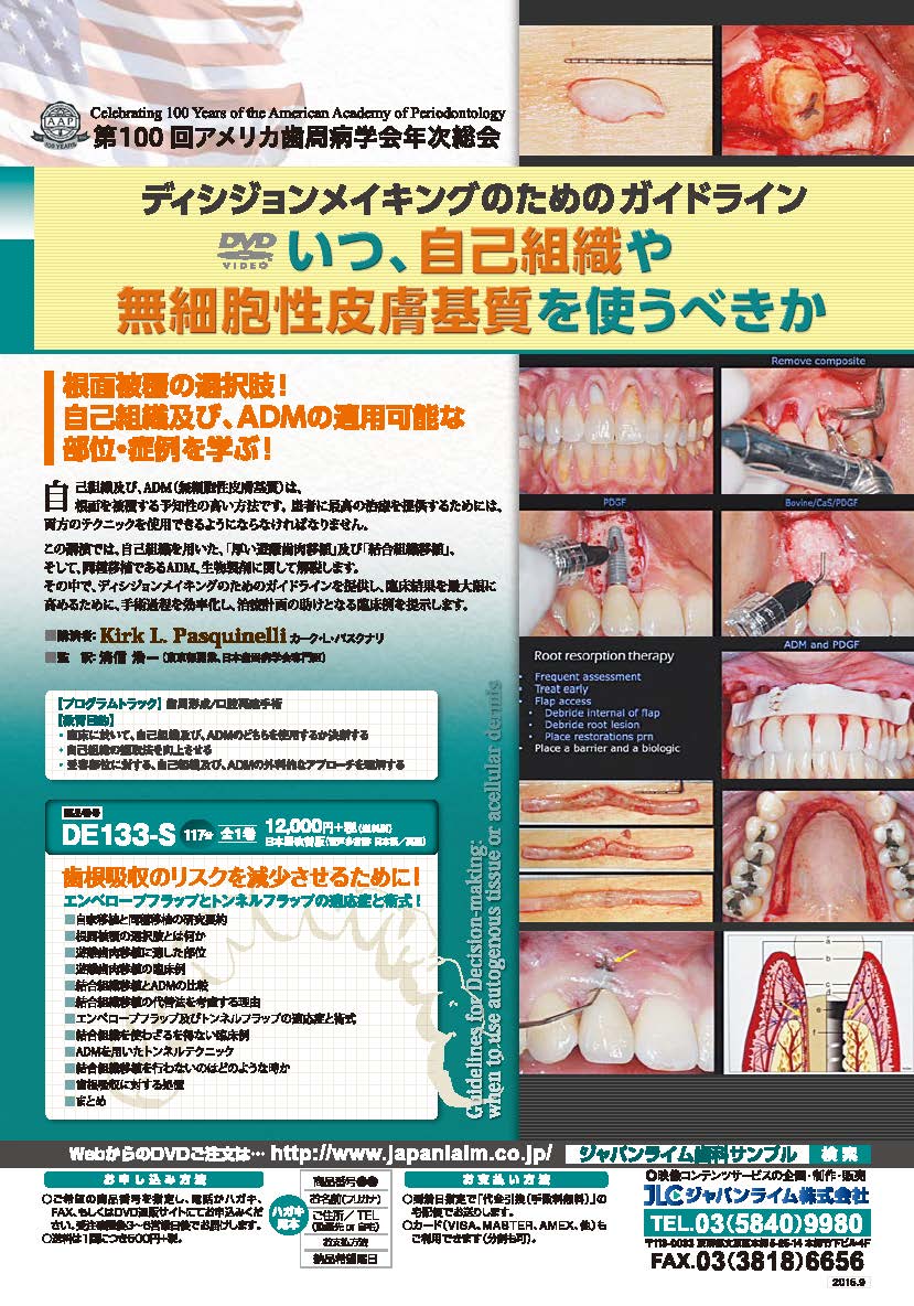 第100回アメリカ歯周病学会年次総会<br>ディシジョンメイキングのためのガイドライン:いつ、自己組織や無細胞性皮膚基質を使うべきか<br>【全1巻】