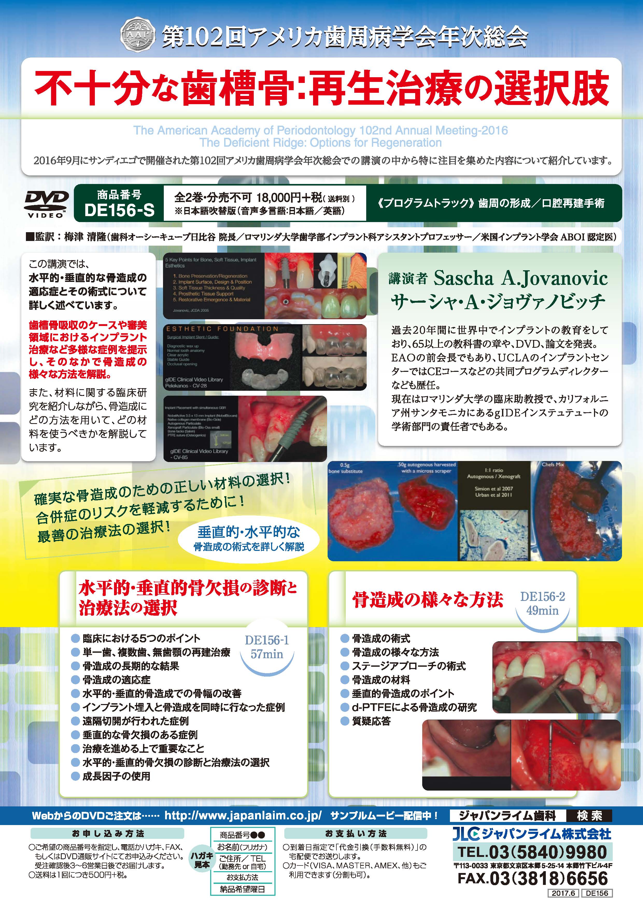第102回アメリカ歯周病学会年次総会<br>「 不十分な歯槽骨 : 再生治療の選択肢 」<br>【全2巻・分売不可】