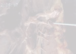 eXg
