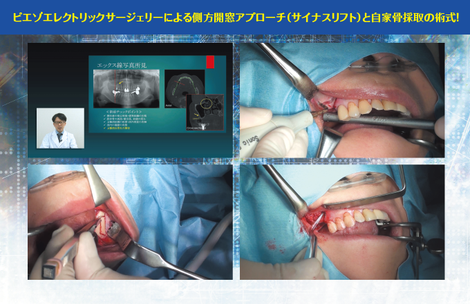 DE151摜2