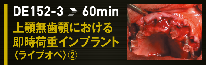 DE152-1画像