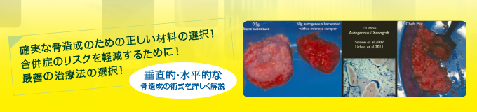 DE156画像