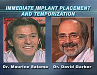 �`�`�[���A�g�����^ Excellence in Dental Implants �V���[�Y�`<br>�����C���v�����g�����ƃe���|�����[�[�V����(���i�ԍ� DE77-S�j