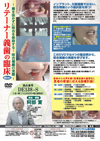 リテーナー義歯の臨床<br>〜歯を抜かずに咬合を保持する!咬合補綴の実際〜<br>【全1巻】
