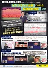 Dr.皆川の 『 リスクを激減させるインプラント埋入法シリーズ 』 基礎編3<br>インプラント治療における軟組織移植術<br>【全3巻・分売不可】