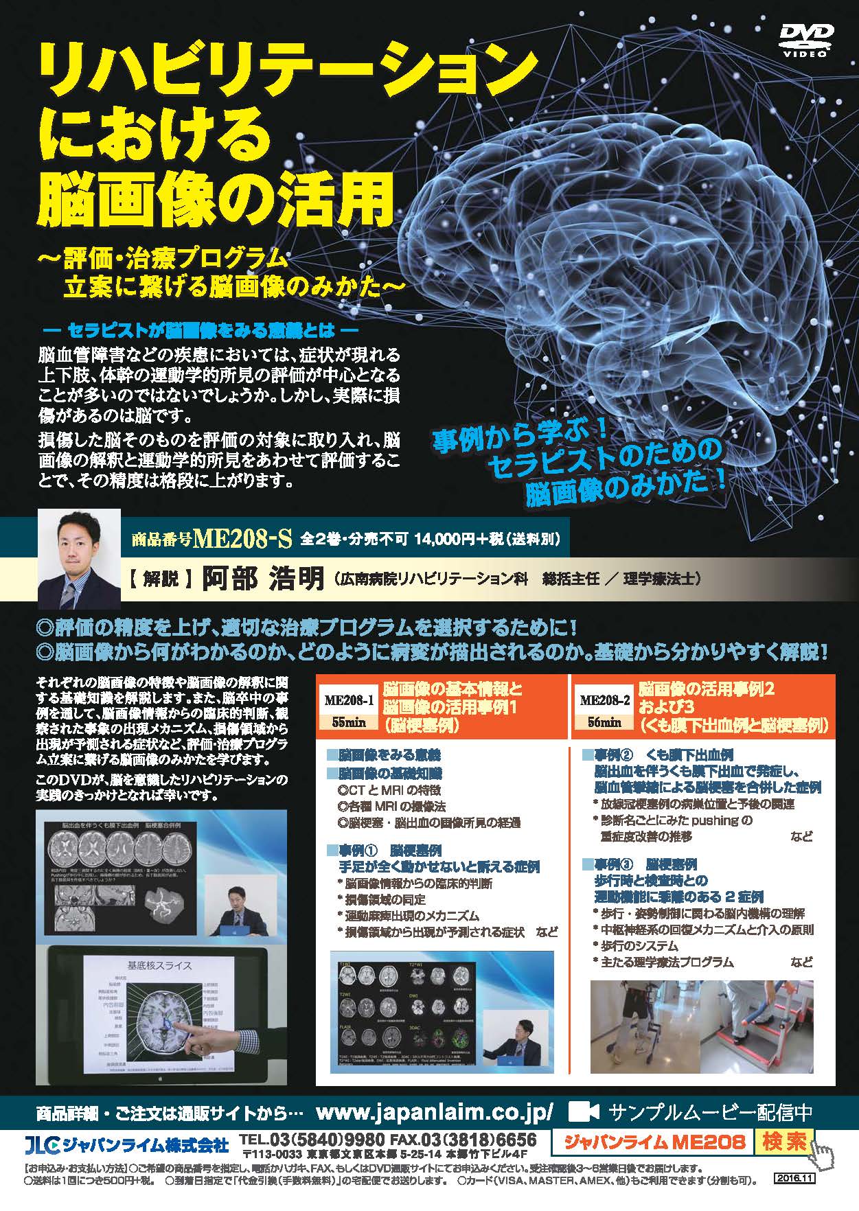 リハビリテーションにおける脳画像の活用<br>〜 評価・治療プログラム立案に繋げる脳画像のみかた 〜<br>【全2巻・分売不可】