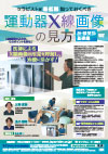 セラピストが最低限知っておくべき運動器X線画像の見方<br>〜股・膝関節 基礎編〜<br>【全2巻・分売不可】