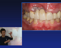 DE150-S Dr.F́wXNCvg@V[Yxb҂R CvgÂɂgDڐAp