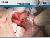 鶴見大学先制医療研究センター 医療技術トレーニングシリーズ<br>ドライマウス(口腔乾燥症)の原因と対処法<br>〜診断と治療の実際〜(全1枚)(商品番号DE101-S)