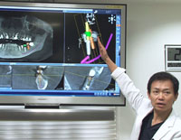 難しい下顎ケースでの正確なピンポイント埋入を可能にする皆川式インプラント