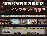 無歯顎多数歯欠損症例におけるインプラント治療<br>〜インプラントオーバーデンチャーとインプラントブリッジ〜<br>【全3巻・分売不可】(商品番号DE175-S)