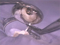 The Art of Endodontics 歯内療法のアート<br>〜最新のテクノロジーを駆使しシステム化された根管治療の実際〜(商品番号DE81-S)