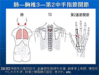 シンクロ矯正法 Part-2～手足の関節の矯正による上位相対関節の可動性 