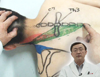 筋および受容器に対する治療的触察 ・ 刺激法 ＜ 体幹 ・ 頚部編 