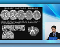 リハビリテーションにおける脳画像の活用<br>〜 評価・治療プログラム立案に繋げる脳画像のみかた 〜<br>【全２巻・分売不可】(商品番号ME208-S)