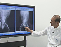 松田教授のよくわかる獣医外科基礎講座「イヌの大腿骨頭切除術」(商品番号VM33-S)