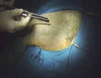 Dr.ペローの 『 整形外科手術テクニック 』<br>〜 イヌの大腿骨骨折の内固定法 〜<br>【全1巻】(商品番号VM59-S)