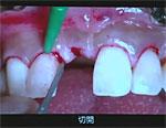 ステップアップ！歯科外科手術　基本編〜インプラント外科成功のための基礎知識とアシスタントワーク〜