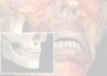 eXg`
