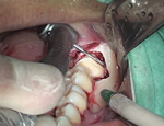 ステップアップ！歯科外科手術　基本編２「麻酔、切開・剥離、縫合」のテクニック
