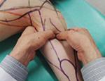 筋および受容器に対する治療的触察・刺激法 ＜骨盤部・下肢編＞（全３枚セット）