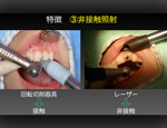 ステップアップ！歯科外科手術　応用編２「 レーザー治療 （ 光歯科治療 ） 最前線 」