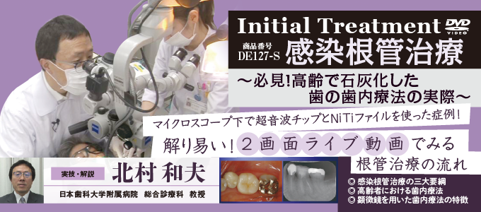 Initial Treatment 感染根管治療〜 必見 ！ 高齢で石灰化した歯の歯内療法の実際 〜（全１枚）