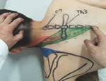 筋および受容器に対する治療的触察 ・ 刺激法 ＜ 体幹 ・ 頚部編 