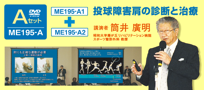 Ａセット 】 投球障害肩の診断と治療 なぜ投球障害肩が起きるのか ...
