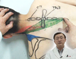 筋および受容器に対する治療的触察・刺激法 ＜体幹・頚部編＞
