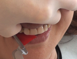 リテーナー義歯の臨床〜 歯を抜かずに咬合を保持する！咬合補綴の実際 〜