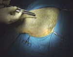 Dr.ペローの 『 整形外科手術テクニック 』〜 イヌの大腿骨骨折の内固定法 〜