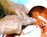 NICUにおける呼吸理学療法のガイドラインに基づく<br>新生児・乳児の呼吸理学療法