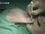 松田教授のよくわかる獣医外科基礎講座「イヌの前十字靭帯断裂の整復法」