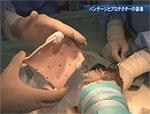 松田教授のよくわかる獣医外科基礎講座「イヌの環軸亜脱臼[環軸不安定症]背側固定術」